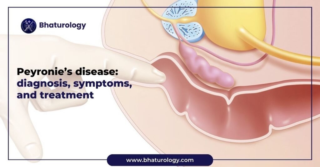 Peyronie’s disease diagnosis, symptoms, and treatment