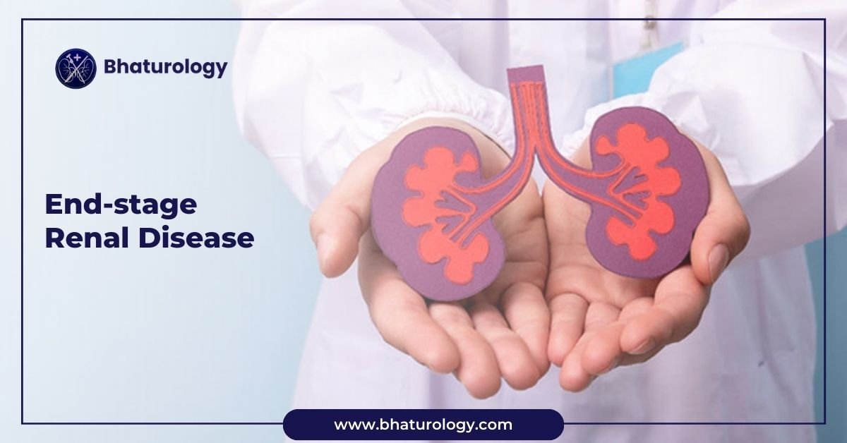 End-stage renal disease